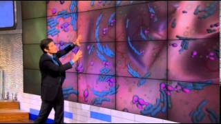 Is Yeast the Reason You're Exhausted? Pt 3