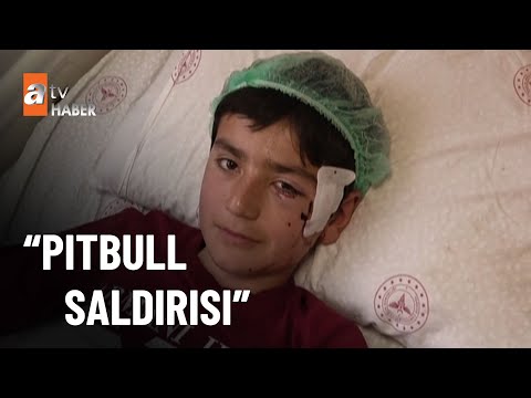 Başıboş pitbull çocuğa saldırdı! - atv Ana Haber 1 Şubat 2023