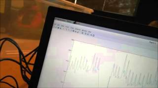 EECS 1011 Lab 4: Counting  heartbeat peaks