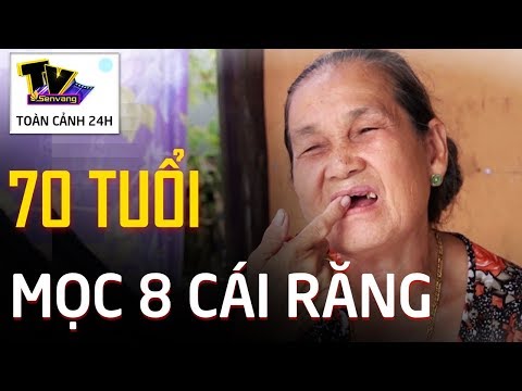 Video Hy hữu - Cụ bà 70 tuổi mọc thêm đến 8 chiếc răng ở An... - youtube