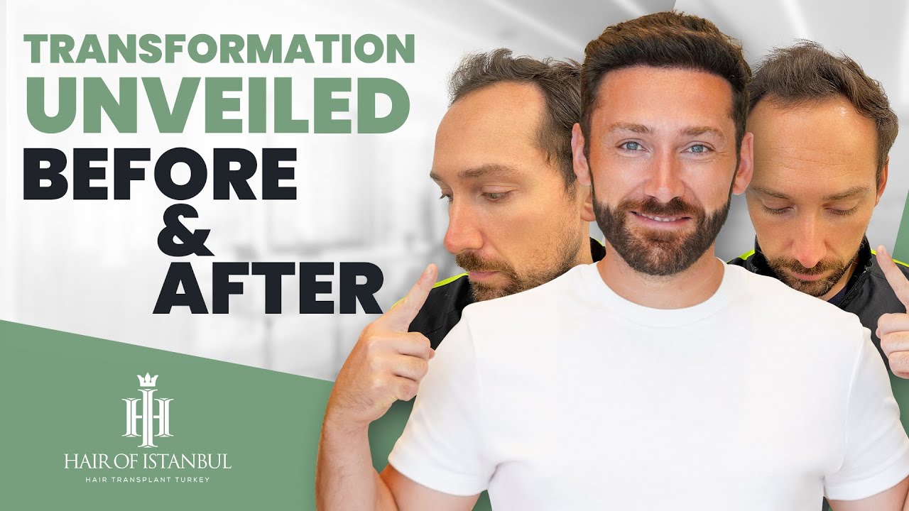 Два брата, одно преображение: путешествие Антонио «Волосы Стамбула»