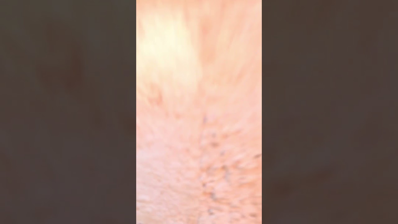 POV: getting a concussion #meme #POV