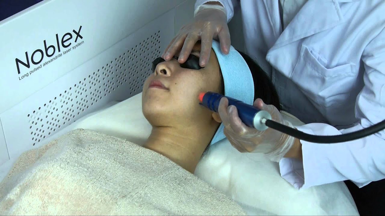 Noblex 755nm Long Pulsed Alexandrite Laser YouTube