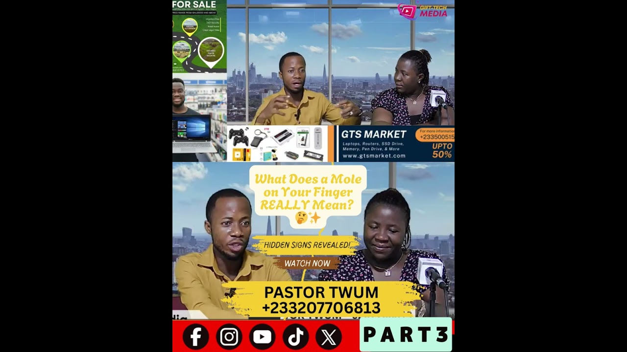 Finger Mole Secrets EXPOSED! 🤯 What It Says About Your Destiny (PART 3)