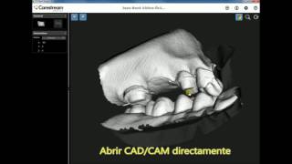 CARESTREAM CS V7 SOFTWARE