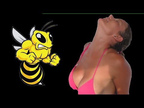 Stung By a Bee In a Special Place -S2:E50