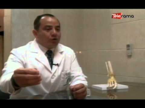 Síntomas del Síndrome de distrofia simpática refleja