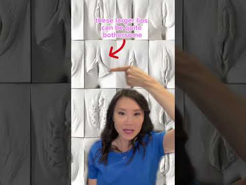 Do You Have A Normal Labia