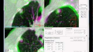 WC2015 Video Selfie - IGRT screenshot 5