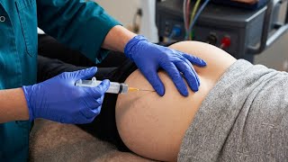 Intramuscular Injection in Hip Explained | Nursing Skills for Students