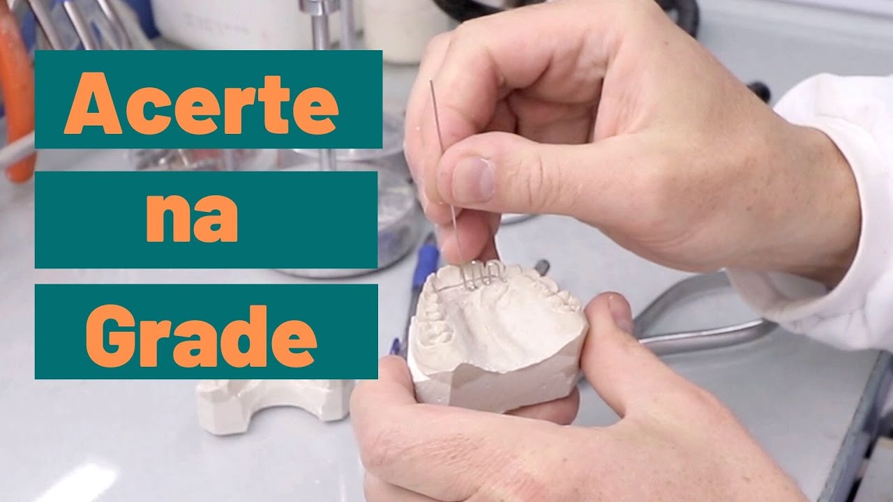 Como acertar o tamanho da GRADE em aparelhos?