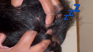 Slow and Relaxing ASMR Head Scratching 😴#asmr