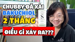 Trải lòng của Dr Chubby sau 2 tháng sử dụng Bakuchiol