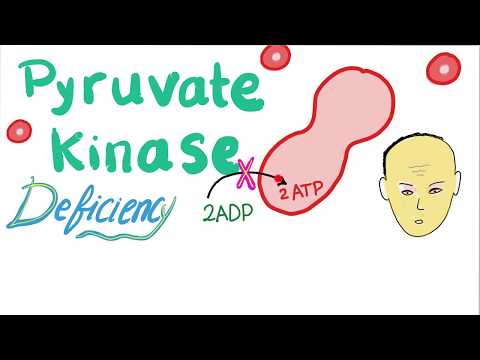 Pyruvate Kinase Deficiency | Hemolytic Anemia