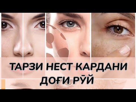 ДОҒИ РУЙ, САБАБИ ПАЙДОИШ. ТАРЗИ ТАБОБАТ #доғирӯй #хаётисолим