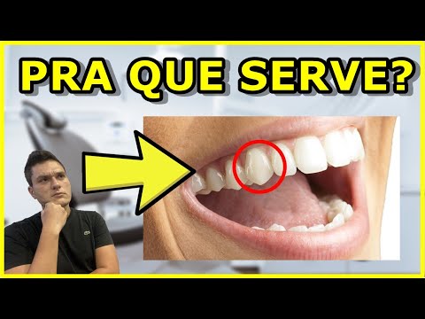 Vídeo: Quais dentes são caninos?