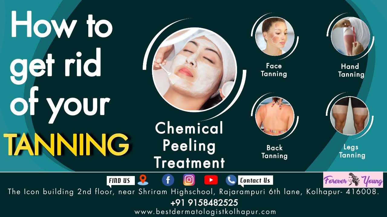 HOW TO GET RID OF YOUR TANNING ( CHEMICAL PEEL TREATMENTS FOR FACE AND