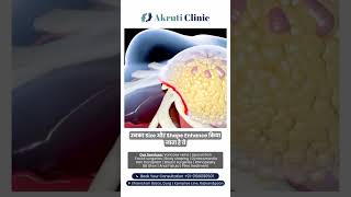 #skincare #yt  #BreastAugmentation #BreastSurgery #CosmeticSurgery #PlasticSurgery #BreastImplants