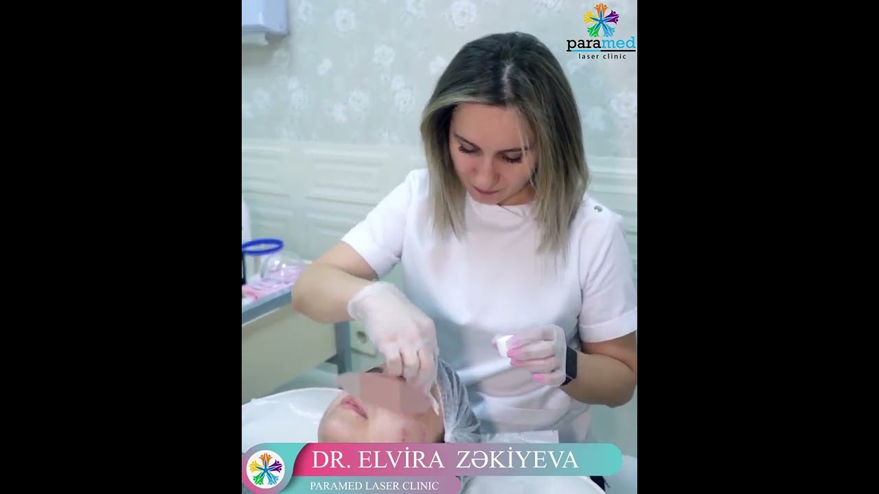 Пилинг лица