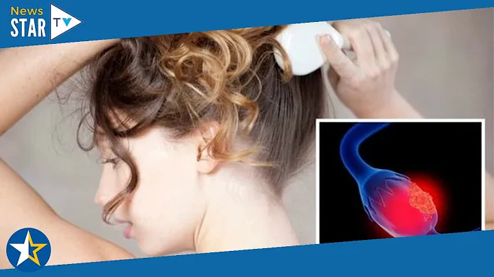 Polycystic ovary syndrome symptoms: The warning sign in your hair - are you affected?