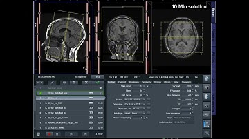 How to MRI of Brain scan protocols, positioning and planning SIEMENS 3T 1.5T