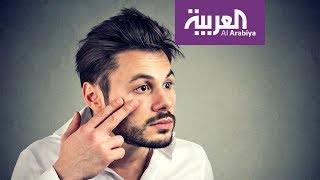 صباح العربية | نصائح للتعامل مع جفاف العين