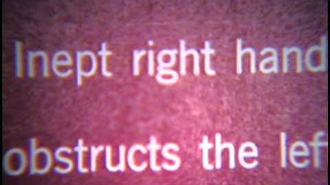 Cerebral Hemispheres 8mm film1