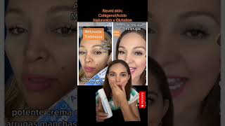 Adiós Manchas Flacidez Arrugas Acné Y Blanquea La Piel Neumi Skin