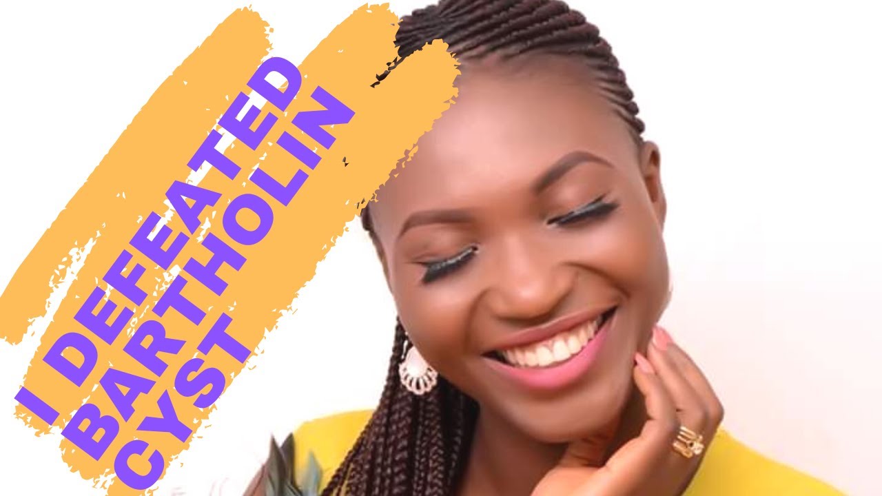 HOW TO TREAT BARTHOLIN CYST AT HOME How I Defeated Bartholin Cyst