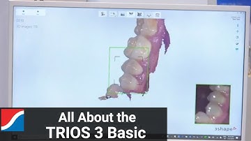 3Shape TRIOS 3 Basic: Features and Benefits