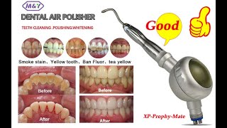 Dental Hygiene Prophy Jet Air Polisher XP-Air prophy jet Prophy-Mate sandblaster Teeth Cleaning