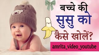 Baby Boy Susu Opening Baby Susu Opening Process Susu Kaise Khola Jata Hai Practical Susu Open