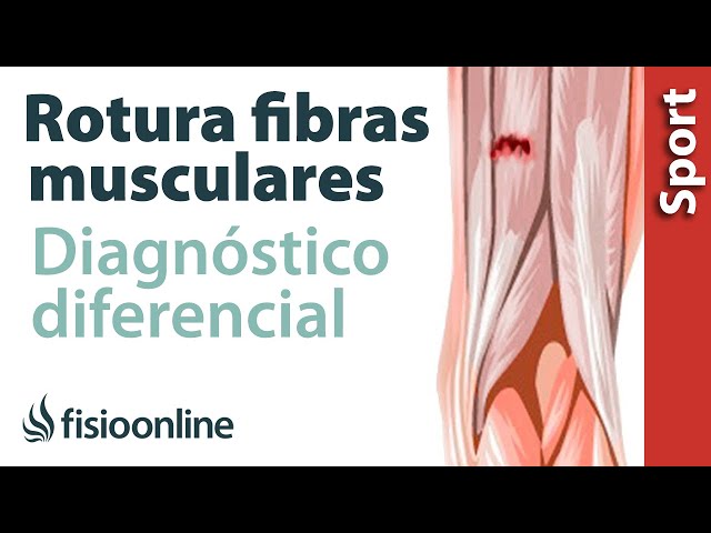 Como curar rapidamente un tiron muscular