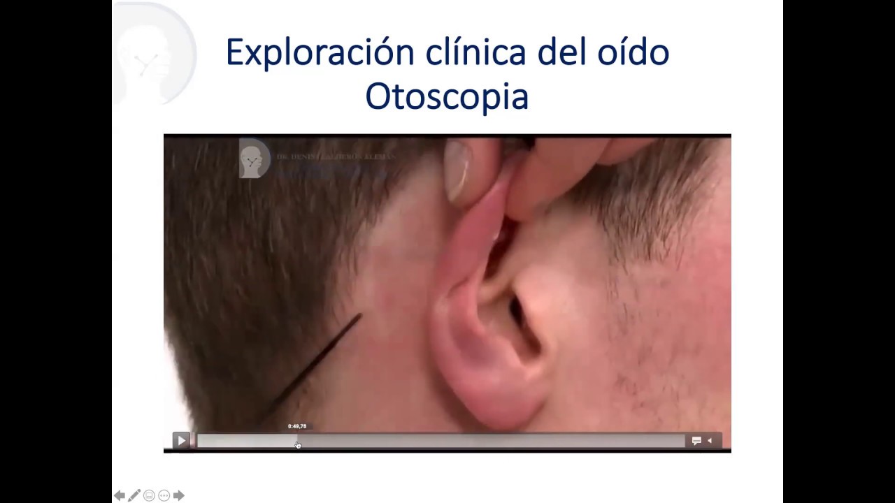 4 .Exploración de oído - Otoscopia