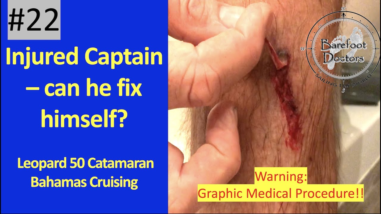 #22. Captain injured - can he fix himself? Leopard 50 - Bahamas Cruising