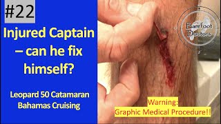 #22.  Captain injured -  can he fix himself? Leopard 50 - Bahamas Cruising