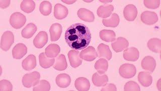 Neutrophils: First Line of Defense