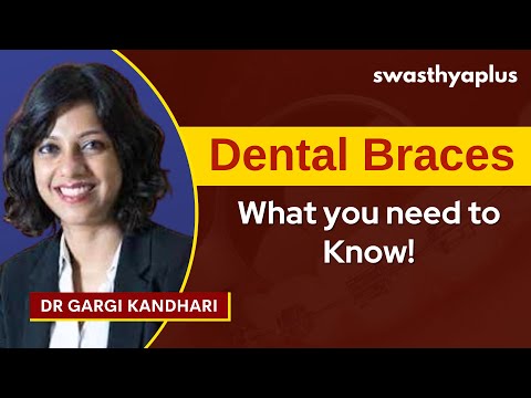 Braces for Teeth / Dental Braces | How Do Braces Work to Straighten Your Teeth? | Dr Gargi Kandhari