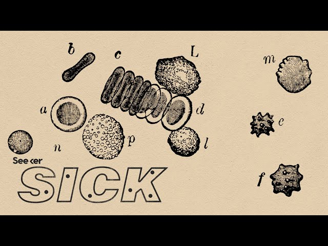 What Exactly is Lupus?