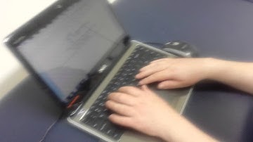 Dynamic Radial Nerve Palsy Splint