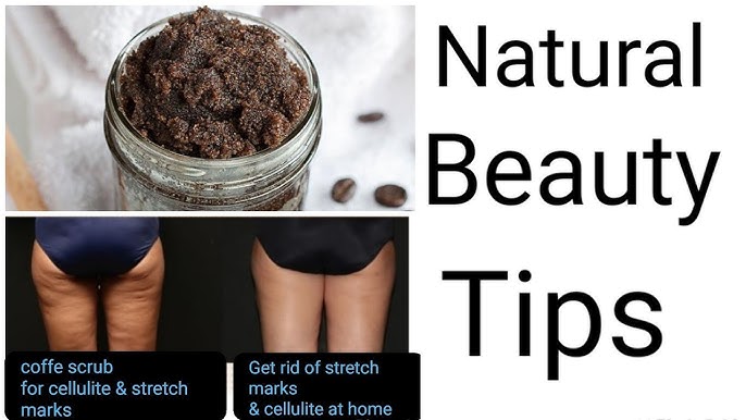 How To Treat Stretch Marks Cellulite With Coffee Sugar Scrub Coffee Scrub For Stretch Marks Youtube