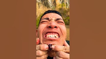 How l Cured a Bug Bite with Yoghurt in the Wild l Survival Hacks