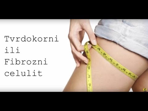 Konačno rešenje za duboki i uporni celulit