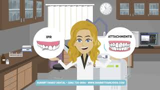 How Invisalign Works at Summit Family Dental