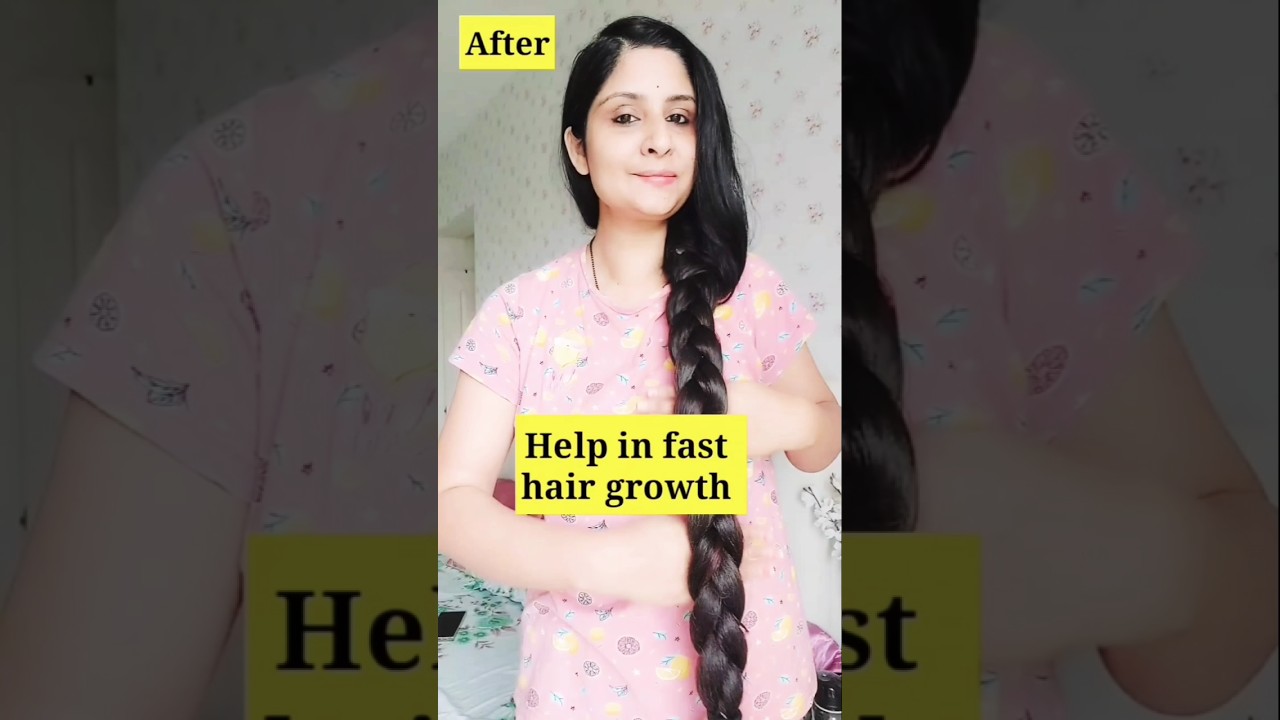 💇‍♀️ Hair Fall Problem? Stop It Naturally! 🌿✨