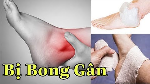 Làm thế nào khi bi bong gân cổ chân?