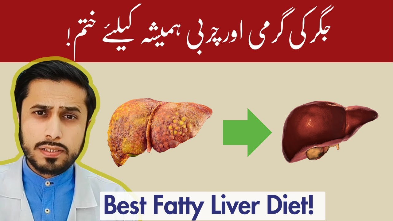 Eat These 3 Things & Your Liver Problems Fatty Liver Treatment