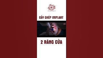 Quá Trình Cấy Implant 2 Răng Cửa#shorts