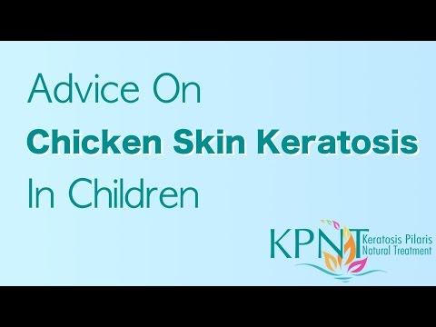 Advice On Chicken Skin Keratosis In Children Video