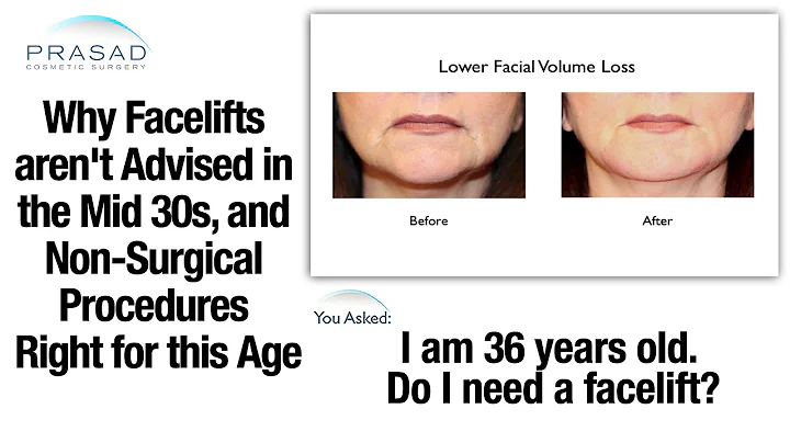 Why Facelifts are Generally Not Advised in the Mid 30s, and Procedures Right for this Age - DayDayNews